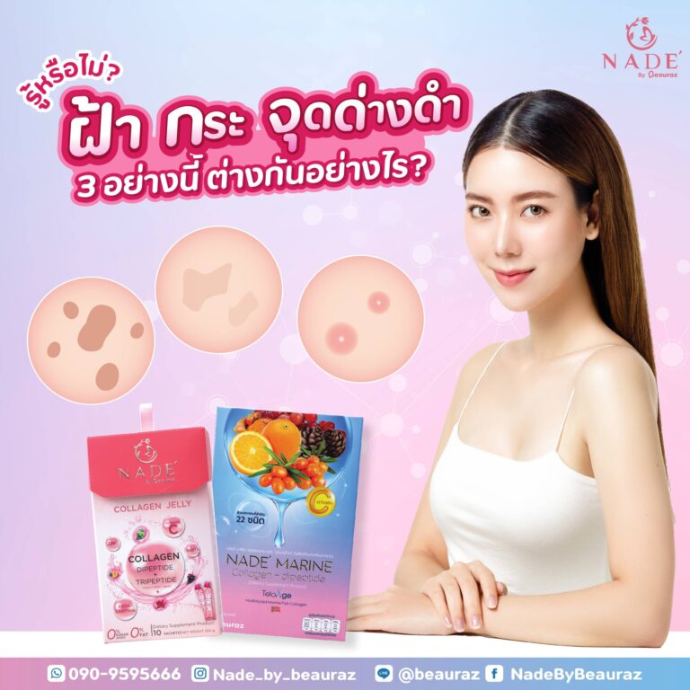 ฝ้า กระ จุดด่างดำ